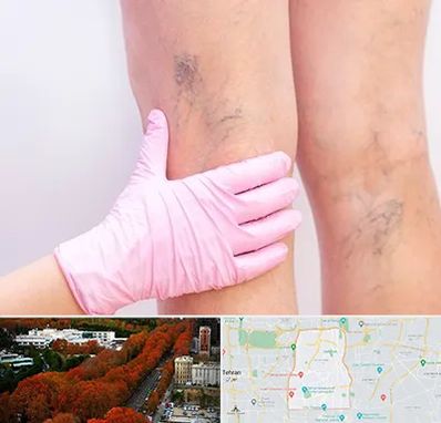 دکتر فوق تخصص واریس در منطقه 6 تهران 