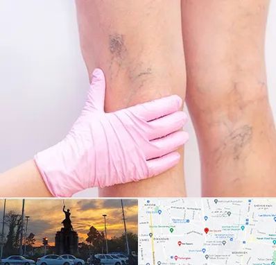 دکتر فوق تخصص واریس در میدان حر 