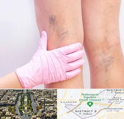 دکتر فوق تخصص واریس در نارمک 