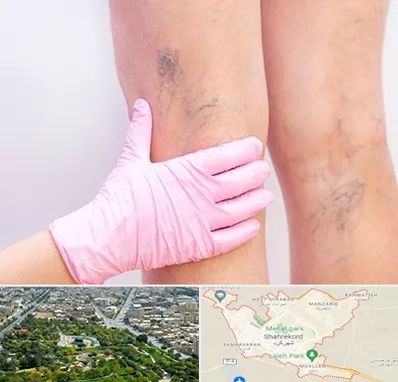 دکتر فوق تخصص واریس در شهرکرد