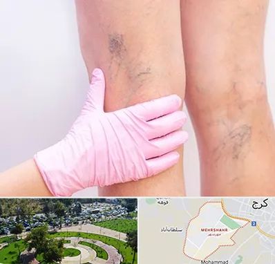 دکتر فوق تخصص واریس در مهرشهر کرج 