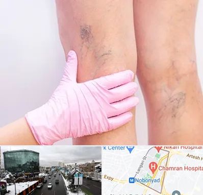 دکتر فوق تخصص واریس در اقدسیه 