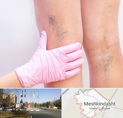 دکتر فوق تخصص واریس در مشکین دشت