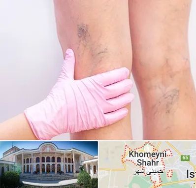 دکتر فوق تخصص واریس در خمینی شهر