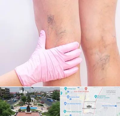 دکتر فوق تخصص واریس در بهارستان 