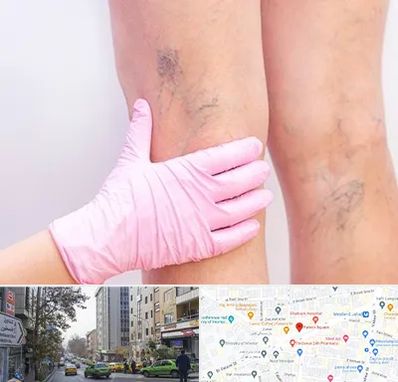 دکتر فوق تخصص واریس در فاطمی 