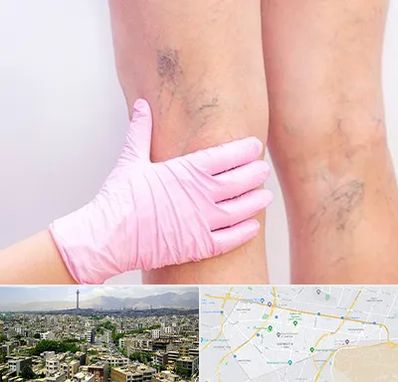 دکتر فوق تخصص واریس در منطقه 8 تهران 