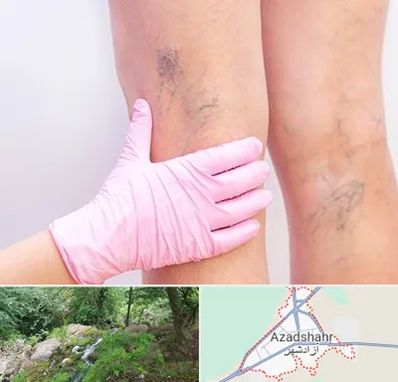 دکتر فوق تخصص واریس در آزادشهر
