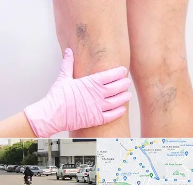 دکتر فوق تخصص واریس در قدوسی شرقی شیراز 