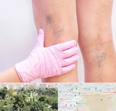 دکتر فوق تخصص واریس در منطقه 13 تهران 