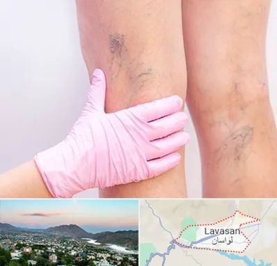 دکتر فوق تخصص واریس در لواسان