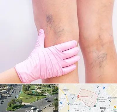 دکتر فوق تخصص واریس در شاهین ویلا کرج 