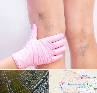 دکتر فوق تخصص واریس در الهیه مشهد 