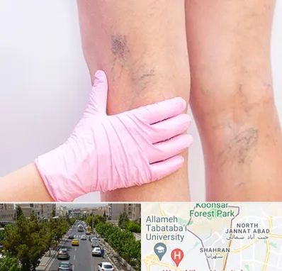 دکتر فوق تخصص واریس در شهران 