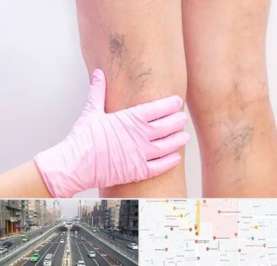 دکتر فوق تخصص واریس در توحید 