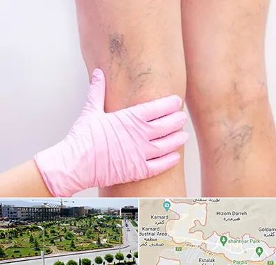 دکتر فوق تخصص واریس در پردیس