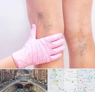 دکتر فوق تخصص واریس در منطقه 10 تهران 