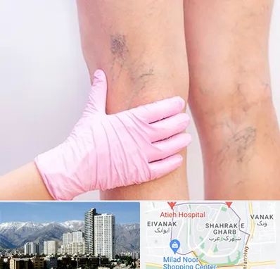 دکتر فوق تخصص واریس در شهرک غرب 