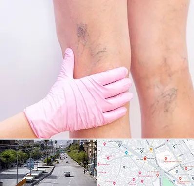 دکتر فوق تخصص واریس در خیابان زند شیراز 