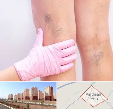 دکتر فوق تخصص واریس در پردیسان قم