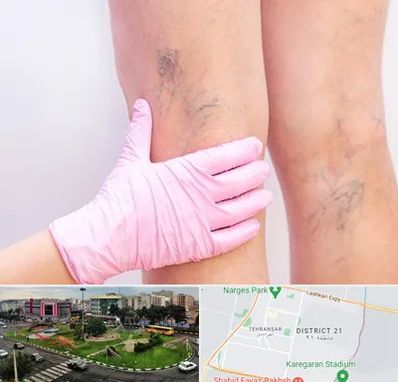 دکتر فوق تخصص واریس در تهرانسر 