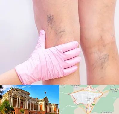 دکتر فوق تخصص واریس در خوی