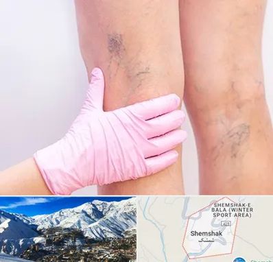 دکتر فوق تخصص واریس در شمشک