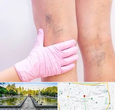 دکتر فوق تخصص واریس در سرسبز 