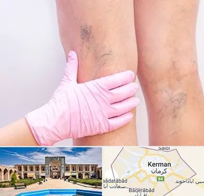 دکتر فوق تخصص واریس در کرمان