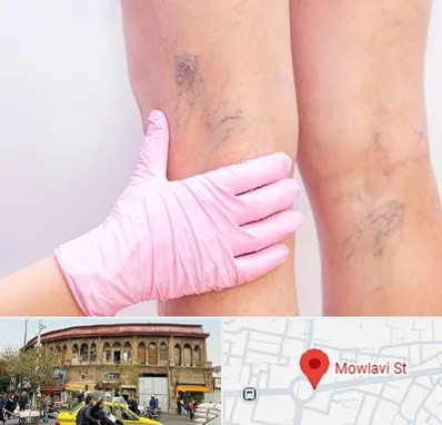دکتر فوق تخصص واریس در مولوی