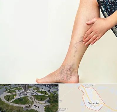 دکتر واریس در ورامین