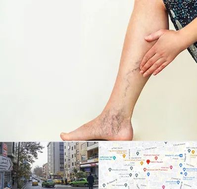 دکتر واریس در فاطمی 