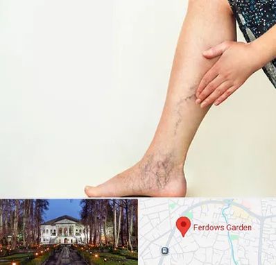 دکتر واریس در باغ فردوس