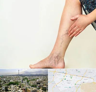 دکتر واریس در منطقه 8 تهران 