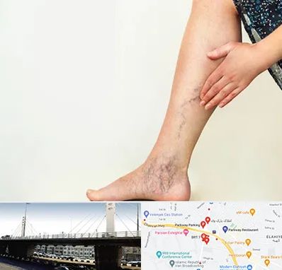 دکتر واریس در پارک وی 