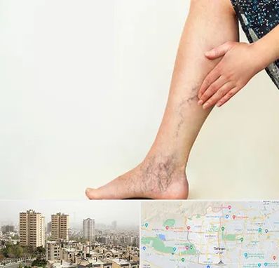 دکتر واریس در منطقه 5 تهران 