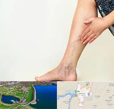 دکتر واریس در مهاباد