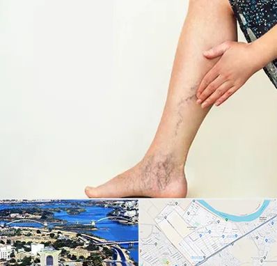 دکتر واریس در کوروش اهواز 