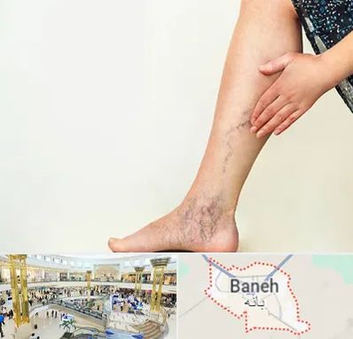 دکتر واریس در بانه