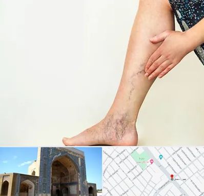 دکتر واریس در مصلی مشهد