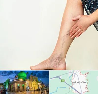 دکتر واریس در آستانه اشرفیه