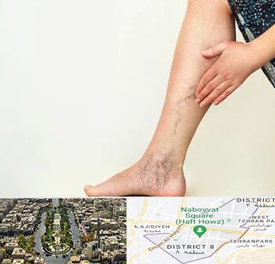 دکتر واریس در نارمک 