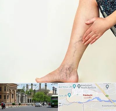 دکتر واریس در پاکدشت