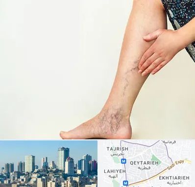 دکتر واریس در قیطریه 