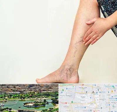 دکتر واریس در منطقه 9 تهران 