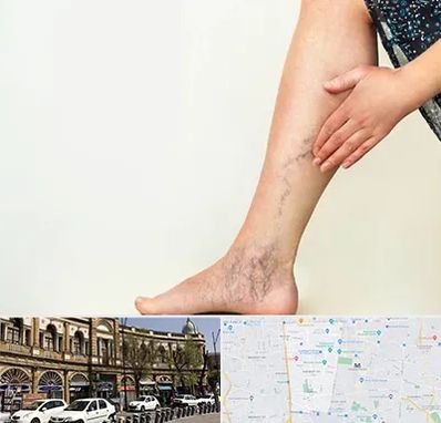 دکتر واریس در منطقه 11 تهران 