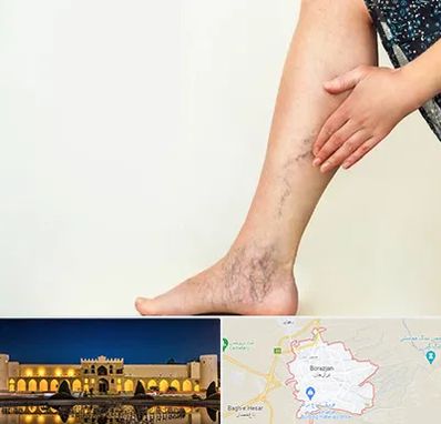 دکتر واریس در برازجان