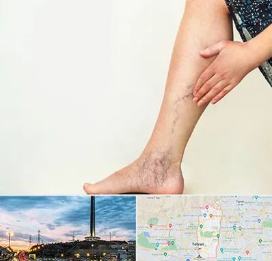 دکتر واریس در منطقه 2 تهران 