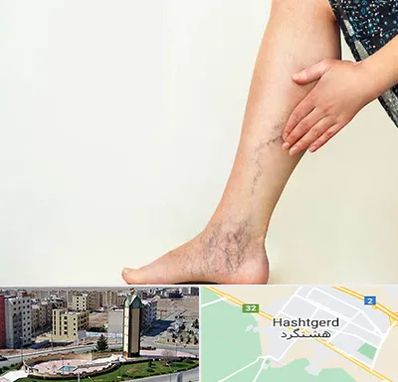 دکتر واریس در هشتگرد