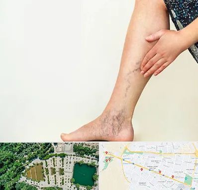 دکتر واریس در وکیل آباد مشهد 